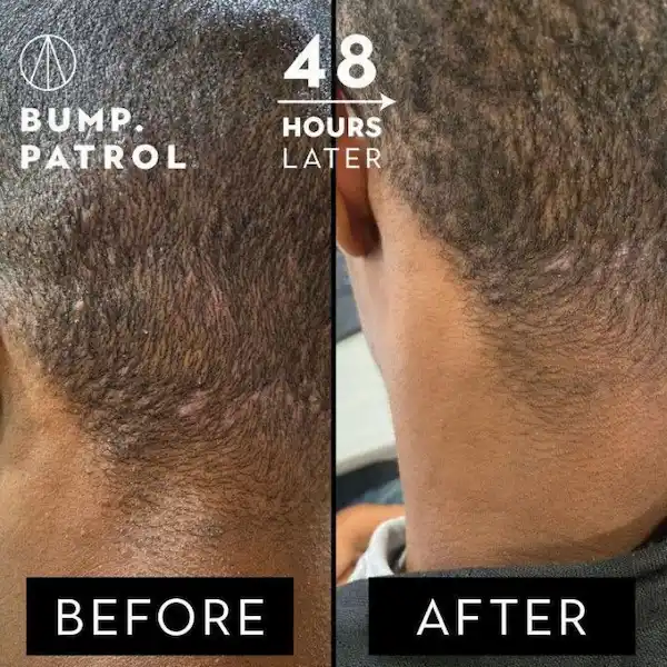 Après-Rasage Aftershave - Bump Patrol - Image 3