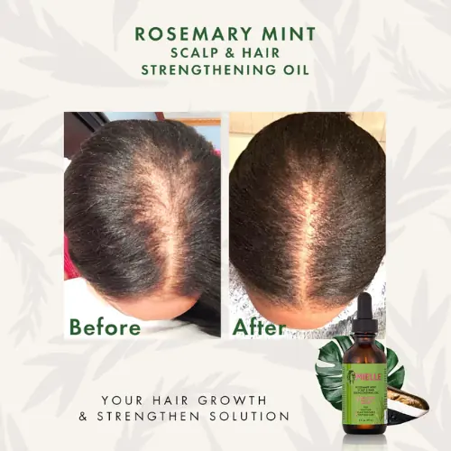 Huile Capillaire Rosemary Mint Oil - Mielle - Image 3